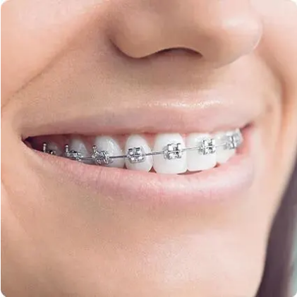 Screenshot_2021-05-20 Elektrický zubní kartáček Oral-B Teen Bílá Oral-B